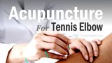 Is Acupuncture an effective treatment for Tennis Elbow?