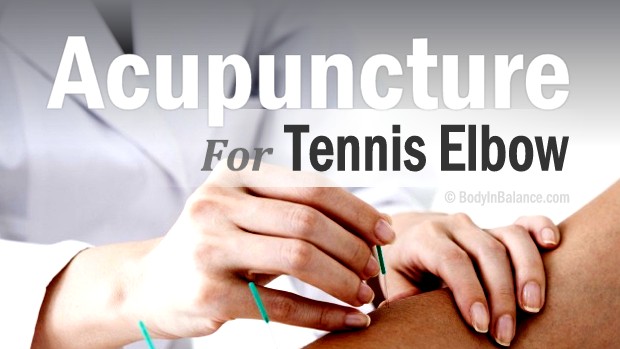 Acupuncture For Treating Golfer's And Tennis Elbow – Body In Balance