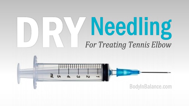 Dry Needling as a treatment for Tennis Elbow