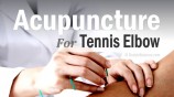 Acupuncture For Treating Golfer’s And Tennis Elbow